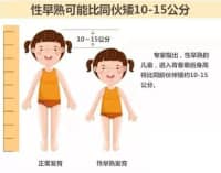 孩子长不高、性早熟，免费测骨龄来啦！骨龄仪免费检测义诊！