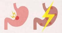 出现多食、易饥等情况？要及时进行这3种原发病的筛查